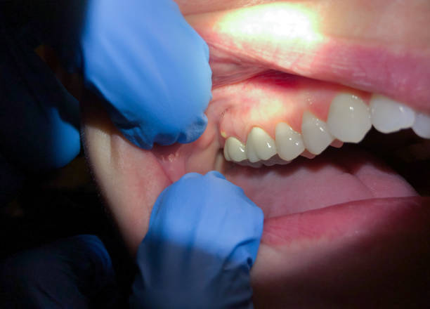 Best Pediatric Emergency Dentist in Walnut Creek, CA