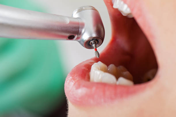 Best Weekend Emergency Dentist in Walnut Creek, CA